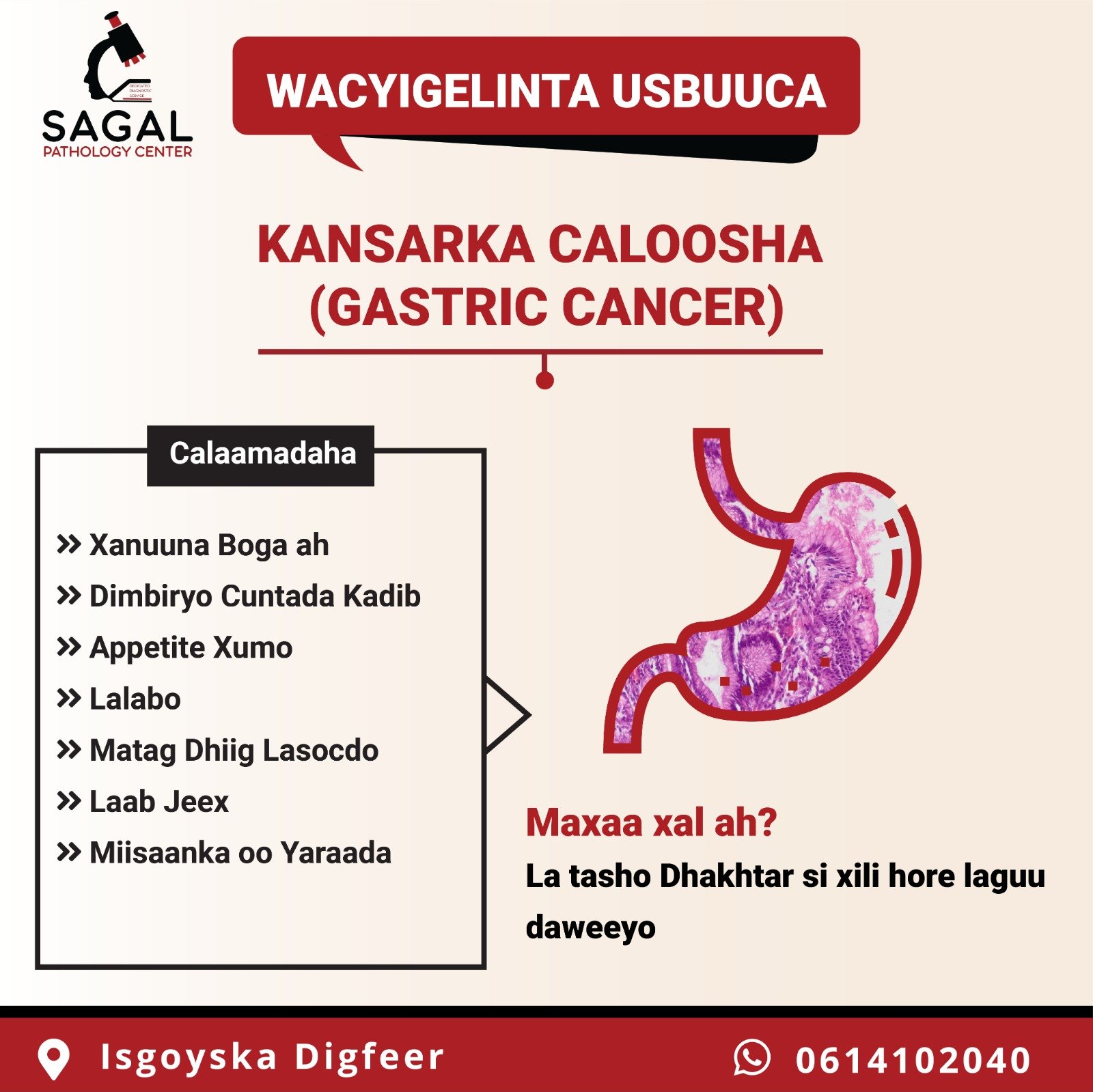 Kansarka Caloosha (Gastric Cancer)